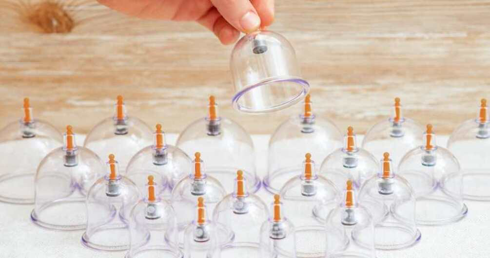 Cupping Therapy